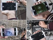 Endoscope2